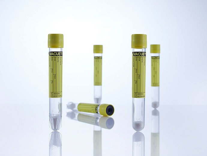 VACUETTE® Urine System Product Line. Greiner Bio-One Preanalytics