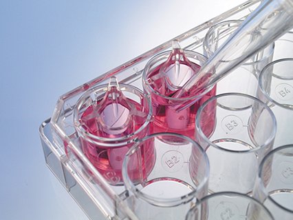 ThinCert® Cell Culture Inserts