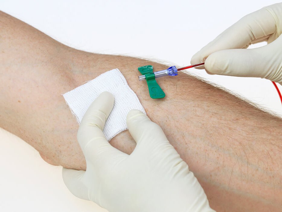 Butterfly Needle for Blood Draw: How It Works and Why It's Used