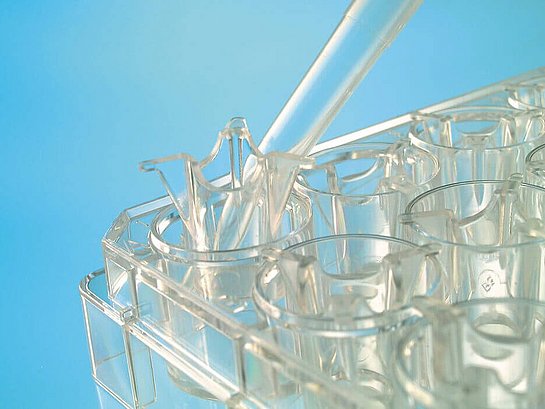 ThinCert Cell Culture Inserts as a Useful Tool for COVID-19 Research
